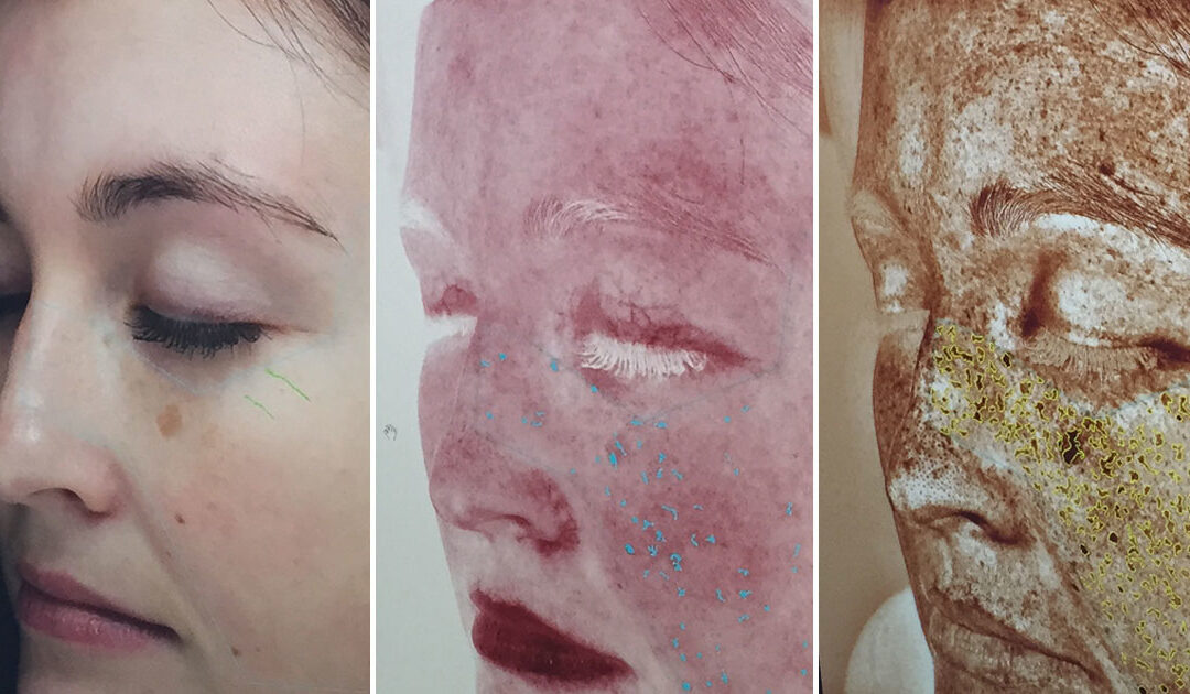 Undo Summer’s Damage to Your Skin