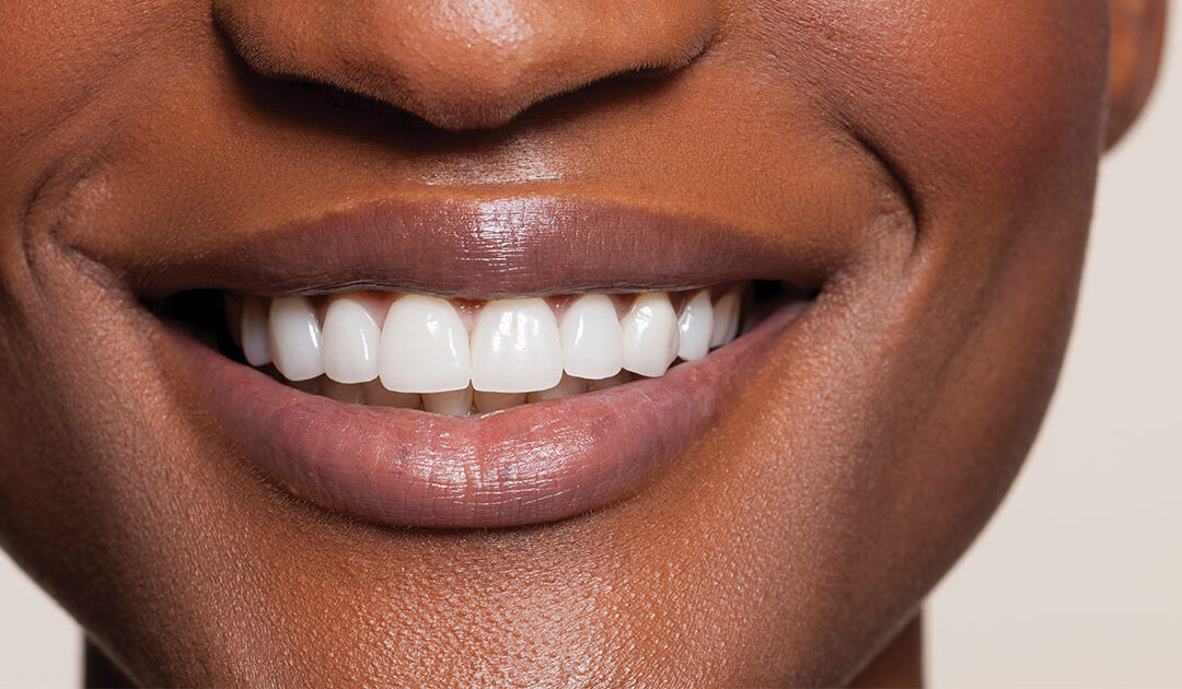 Finding Your Smile Again Through Cosmetic Dentistry
