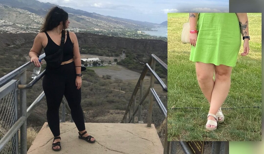 11% of Women Have Lipedema—Are You One of Them?