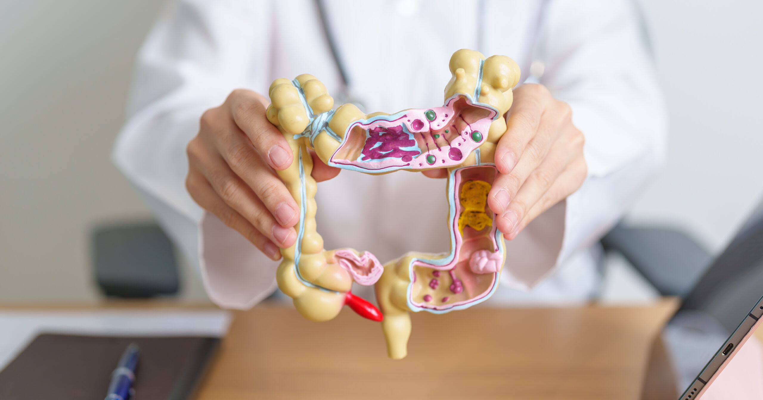 Colorectal cancer screening guidelines